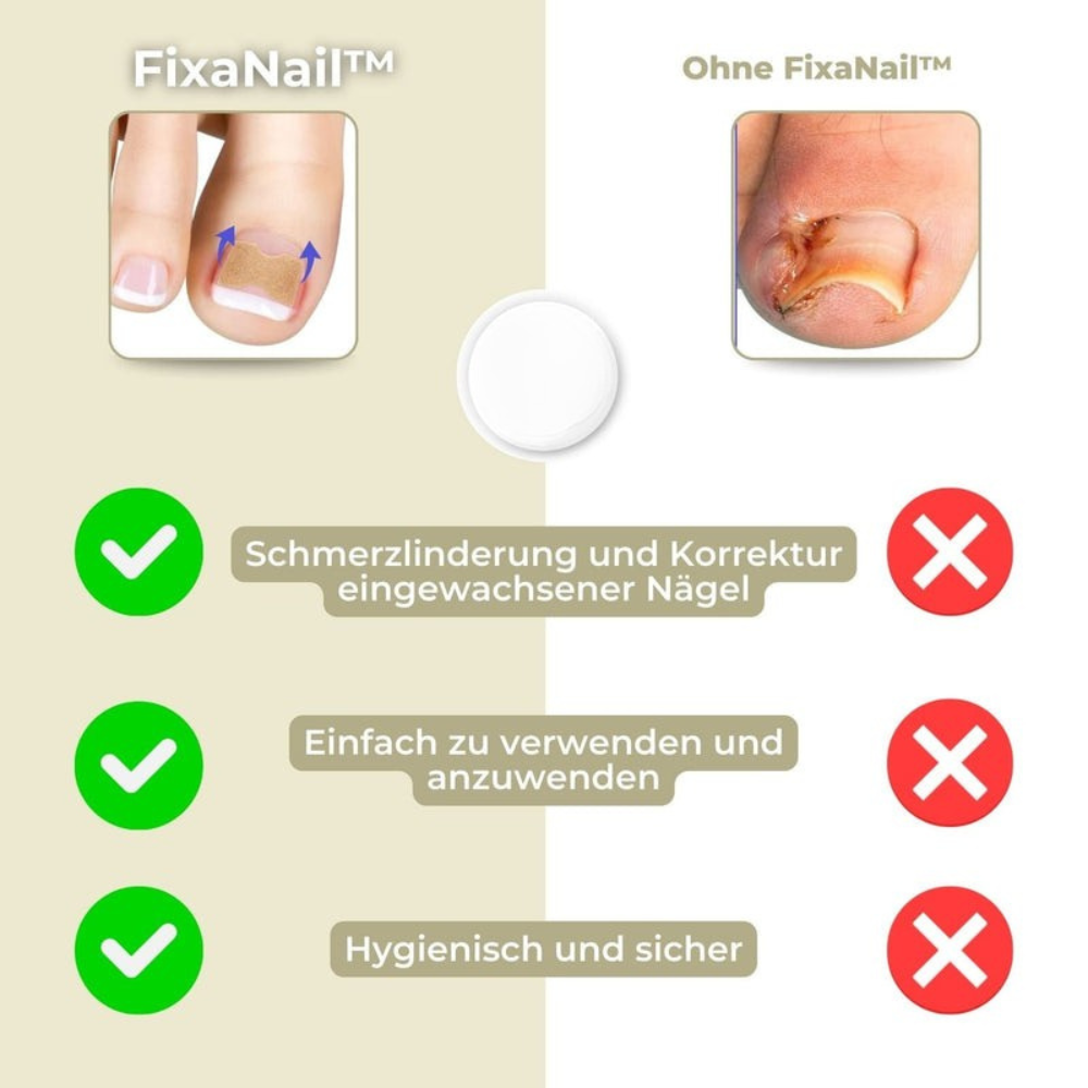 NAILFIXA – Instant Nail Repair Kit for Stronger Nails