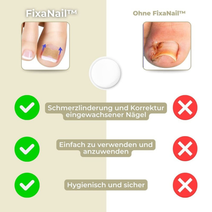 NAILFIXA – Instant Nail Repair Kit for Stronger Nails