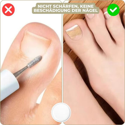 NAILFIXA – Instant Nail Repair Kit for Stronger Nails