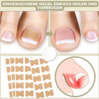 NAILFIXA – Instant Nail Repair Kit for Stronger Nails