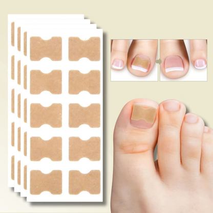 NAILFIXA – Instant Nail Repair Kit for Stronger Nails