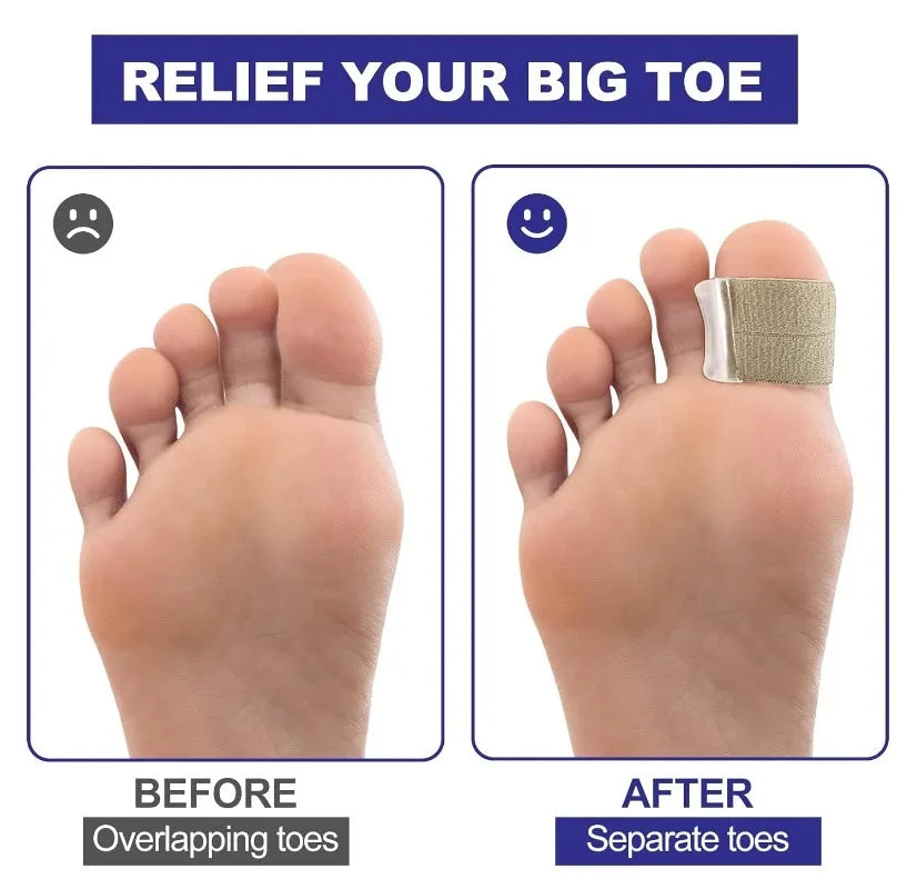 TOESPACER – Gel toe separators for bunion relief and toe alignment