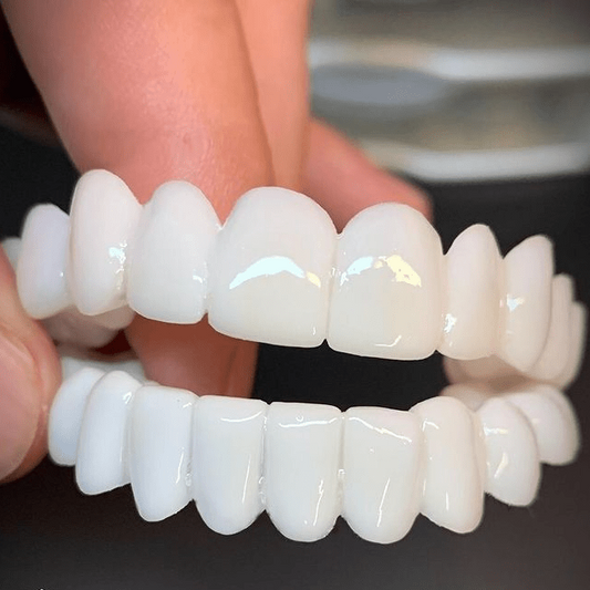 PEARLDENT – Cosmetic dental prosthesis with white dental lenses