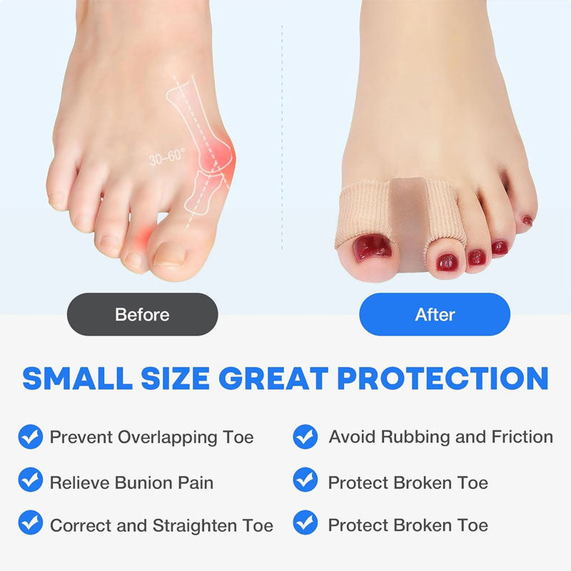 ALIGNFLOW – Toe Corrector for Everyday Comfort and Natural Alignment