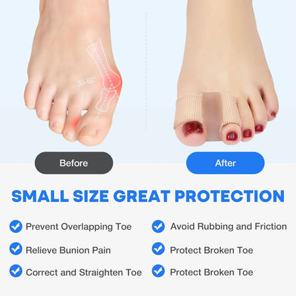 ALIGNFLOW – Toe Corrector for Everyday Comfort and Natural Alignment